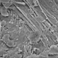 Asbesthaltiger Serpentinit - Aufnahme mit dem Elektronenmikroscop